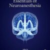 Essentials of Neuroanesthesia eBook