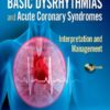 Huszar’s Basic Dysrhythmias and Acute Coronary Syndromes: Interpretation and Management Text & Pocket Guide Package – E-Book eBook
