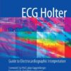 ECG Holter: Guide to Electrocardiographic Interpretation eBook