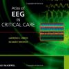 Atlas of EEG in Critical Care eBook