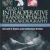 Atlas of Intraoperative Transesophageal Echocardiography eBook