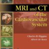 MRI and CT of the Cardiovascular System, 2nd edition eBook