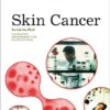 Skin Cancer (The Biology of Cancer) eBook