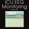 Handbook of ICU EEG Monitoring eBook