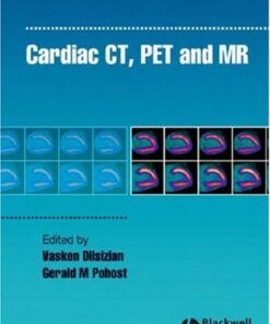 Cardiac CT, PET and MR eBook