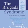 The Brugada Syndrome: From Bench To Bedside eBook