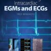 Understanding Intracardiac EGMs and ECGs eBook