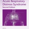 Acute Respiratory Distress Syndrome, Second Edition, Volume 233 (Lung Biology in Health and Disease) eBook