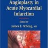 Primary Angioplasty in Acute Myocardial Infarction (Contemporary Cardiology) eBook