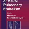 Management of Acute Pulmonary Embolism (Contemporary Cardiology) eBook