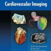 The ESC Textbook of Cardiovascular Imaging eBook
