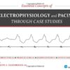Essential Concepts of Electrophysiology and Pacing through Case Studies eBook