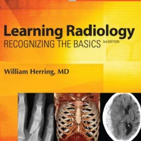 Learning Radiology: Recognizing the Basics 3rd Edition (PDF ebook)